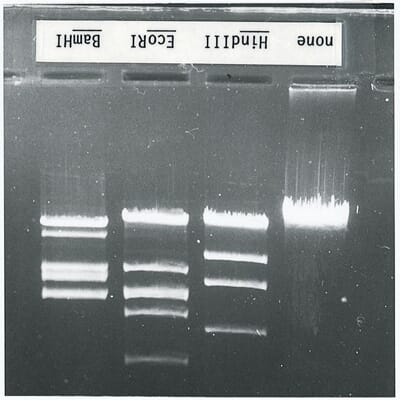 Sett: Restriksjons og DNA-analyse (til std elektroforeseuts)
