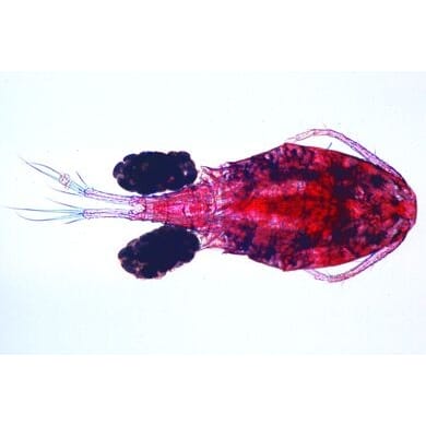11125 Cr113c_daphnia.jpg
